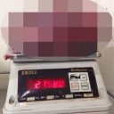 【閲覧注意】摘出された世界最大の腎臓がグロすぎる!!　放置すると恐ろしい「ADPKD」の末路＝インド