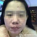 被害女性は自業自得？　“毒パック”で140万円を荒稼ぎしたカリスマ美人バイヤーが失踪