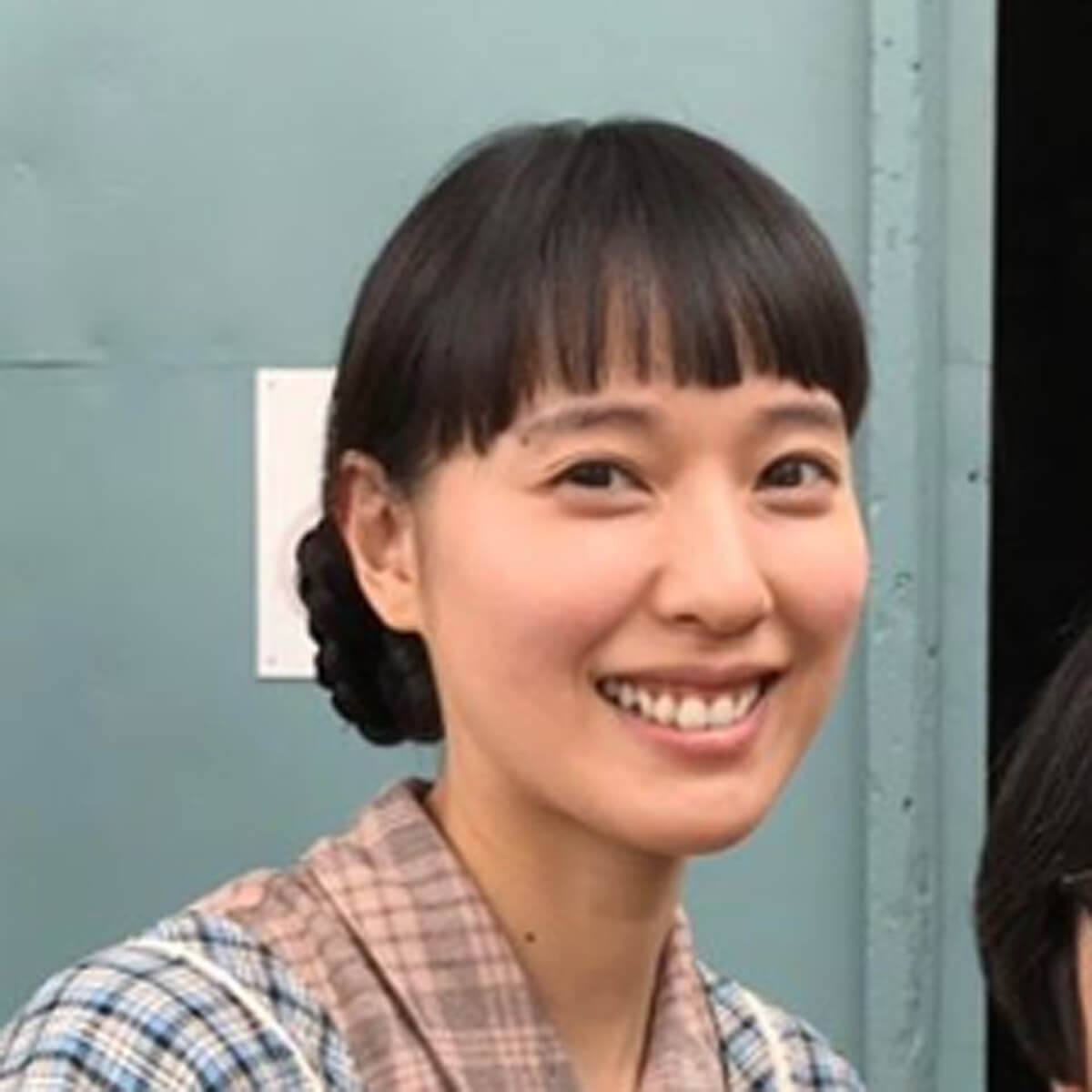 戸田 恵梨香 歯